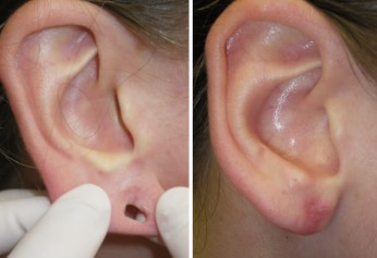 holes in one ear Gauged earrings, Tribal earrings 2 Gauge Stretched ears Ho...